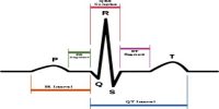 Electrocardiogram (E.C.G)
