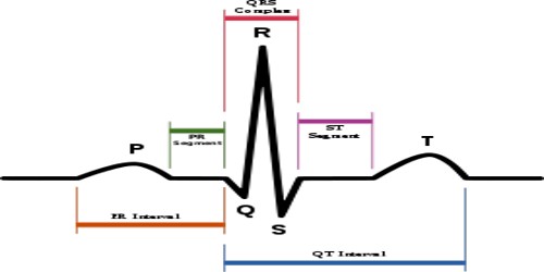 Electrocardiogram (E.C.G)